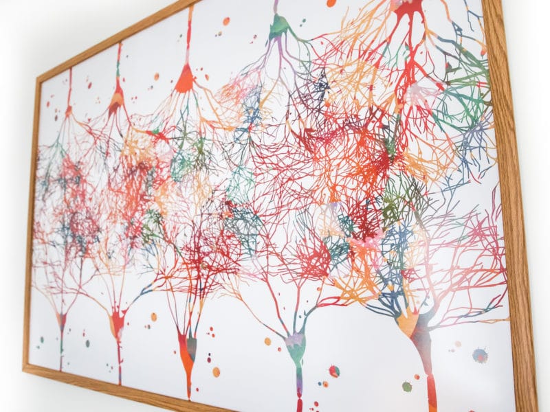 Hopes office art showing neurons firing for emdr